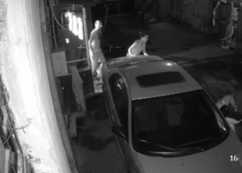 უმძიმესი კადრები – 67 წლის ქალს ძაღლმა მძიმე დაზიანებები მიაყენა – პაციენტის მდგომარეობა კრიტიკულია