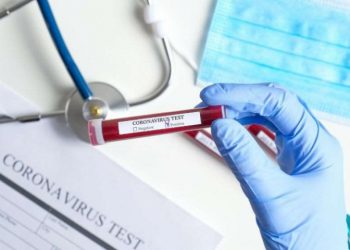 კორონავირუსის 165 ახალი შემთხვევა და არცერთი გამოჯანმრთელებული