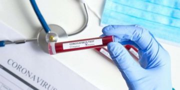 კორონავირუსის 165 ახალი შემთხვევა და არცერთი გამოჯანმრთელებული