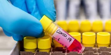 აჭარაში კორონავირუსის 129 შემთხვევაა – 18 სექტემბრის მონაცემები