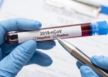 საქართველოში ინფიცირებულთა რაოდენობამ იკლო