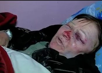 „სულ მუშტები მირტყეს,უთო მოიტანეს, ჩართეს და ვაიმე…“ – საზარელი შემთხვევა ხობში