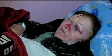 „სულ მუშტები მირტყეს,უთო მოიტანეს, ჩართეს და ვაიმე…“ – საზარელი შემთხვევა ხობში