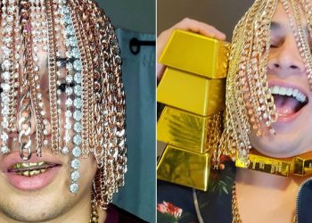 რეპერმა თავზე თმის ნაცვლად ოქროს ჯაჭვები გადაინერგა