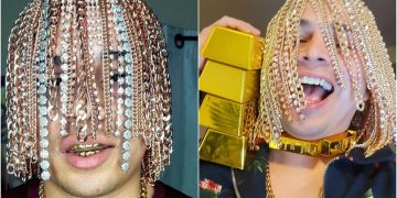 რეპერმა თავზე თმის ნაცვლად ოქროს ჯაჭვები გადაინერგა